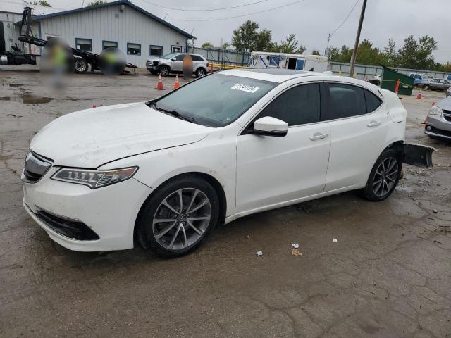 acura tlx 2015 19uub2f33fa005335