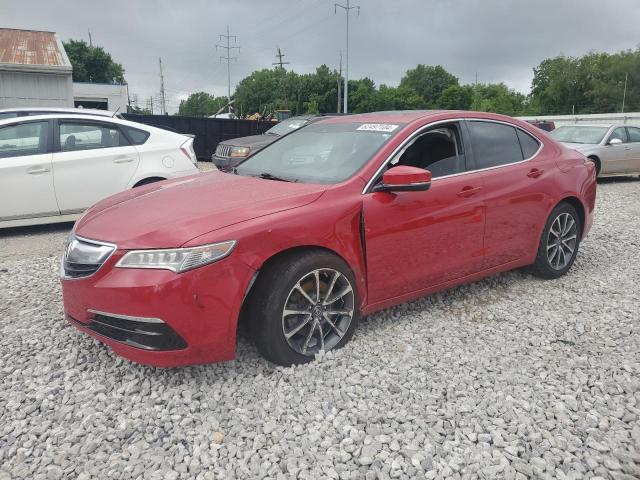 acura tlx tech 2017 19uub3f59ha000246