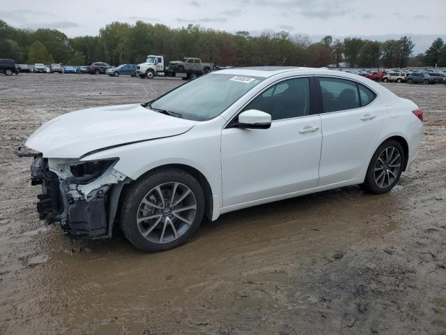 acura tlx advanc 2017 19uub3f71ha001571