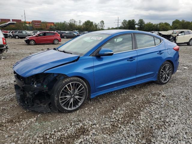 hyundai elantra sp 2017 kmhd04lb9hu364620